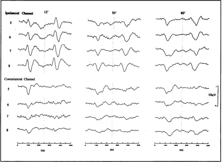 Figure 5.9: Group average ipsilateral and contralateral VEPs for experimental steps 5 t o  8.