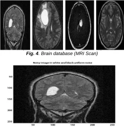 Fig. 4. Brain database (MRI Scan)  