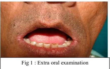 Fig 1 : Extra oral examination 