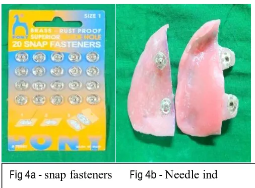 Fig 3 c - photoseal                   Fig 3 d - Aquaseal     