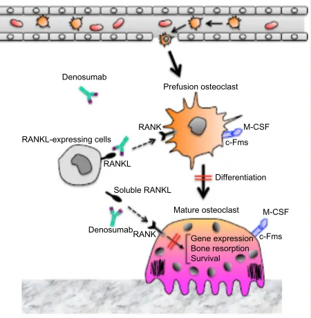 Figure 1 The mechanism of action of denosumab on bone metabolism.Notes: Denosumab (a fully human monoclonal anti-RANKL antibody) binds to osteoblast-produced RANKL, thereby preventing RANKL from binding to the osteoclast receptor, RANK