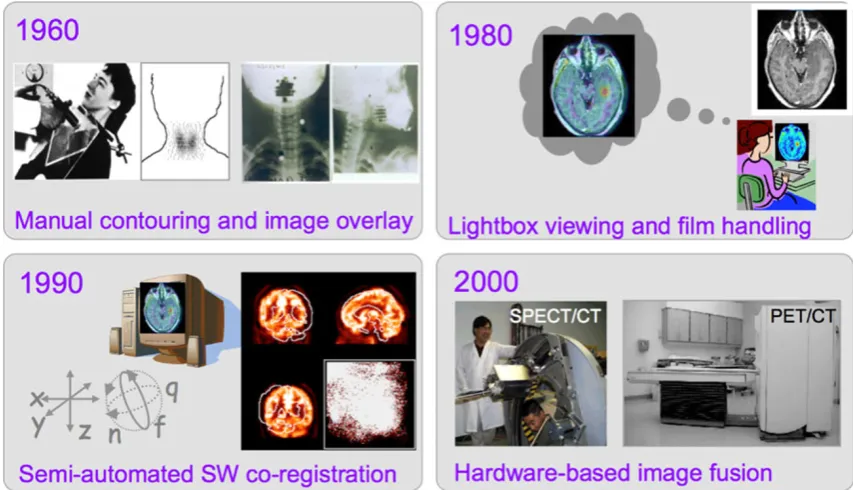 Fig. 2 Attempts to combine anatomical and functional image information in clinical routine from 1960 to 2000