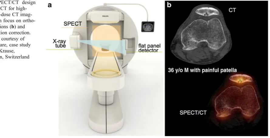 Fig. 6 (with flat panel CT for high-resolution, low-dose CT imag-ing with a main focus on ortho-paedic applications (routine attenuation correction.System images courtesy ofPhilips Healthcare, case studycourtesy of T