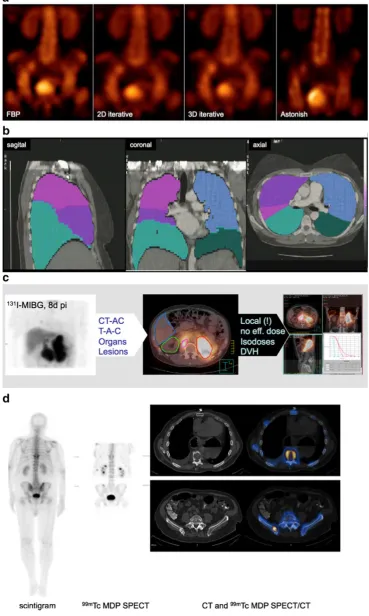 Fig. 7a–d Examples of method-