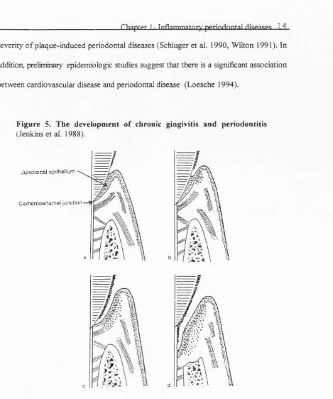 Figure 5. The development of chronic gingivitis and periodontitis