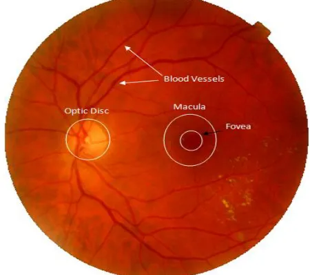 Fig 1  Retinal image with anatomical features such as blood vessels, optic disc, macula and fovea 