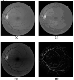 Fig 6(c)                                                 (d) image (b) Shade-corrected image (d) Homogenized image (f) Vessel enhanced image : Preprocessing results (a) Green channel of retinal  