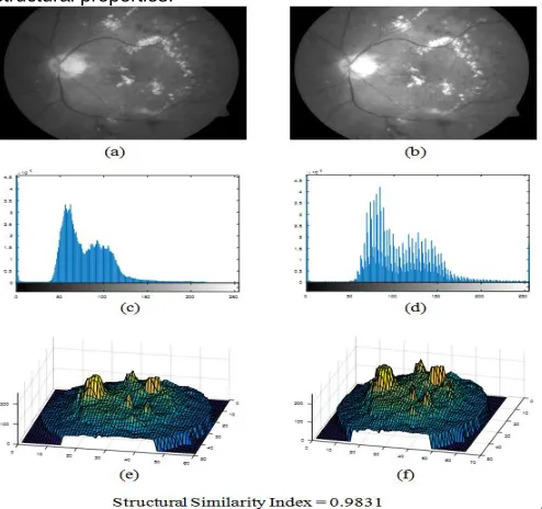 Fig. Comparison of structural properties of green channel with preprocessed 