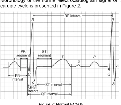 Figure 1: Successive depolarization / repolarization steps of the heart that are electrocardiographically translated by distinct P, QRS, 