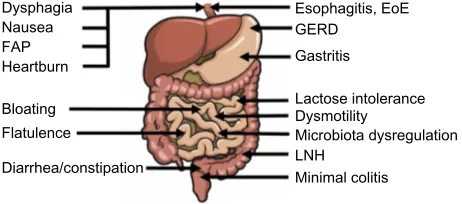 Figure 1 Gi symptoms (left side) and Gi disorders (right side) described in children with autism spectrum disorder.Abbreviations: Gi, gastrointestinal; FAP, functional abdominal pain; eoe, eosinophilic esophagitis; GERD, gastroesophageal reflux disease; LNH, lymphonodular hyperplasia.