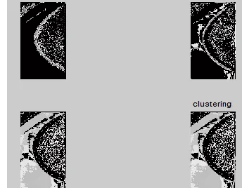Figure 8(a) Mammogram output after Clustering 