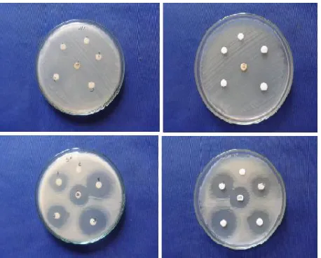 Fig.3.1.6  Antibacterial activity Al doped ZnO Nano particles 