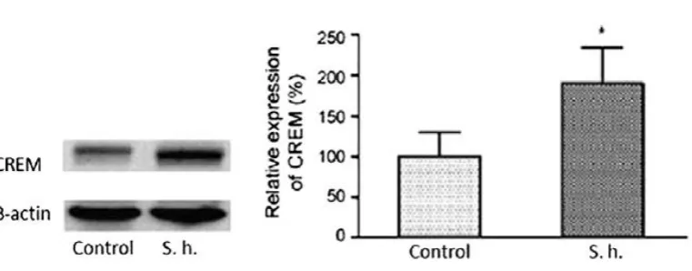 Figure 1:  RT-PCR analysis of CREM gene expression in testis from Salvia hypoleuca-treated rats