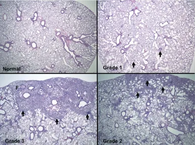 Figure 1 representative lung photomicrographs. Typical images that were used for semiquantitative assessment of lung pathology are shown (4 × magnification)