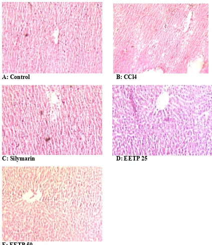 Figure 1: Photomicrograph of liver (10x) (A)hepatocyte necrosis; (C) animal treated with Silymarin showing almost normal liver with little leukocyte infiltration; (D) animals treated with EETP 25 mg/kg showing moderate degree of inflammatory cell infiltrat