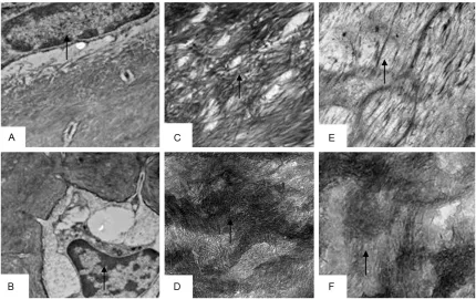 Figure 4. Effects of subchronic co-exposure to lead acetate and cadmium chloride on the structure of rats bone under the transmission electron microscopy for 90 d