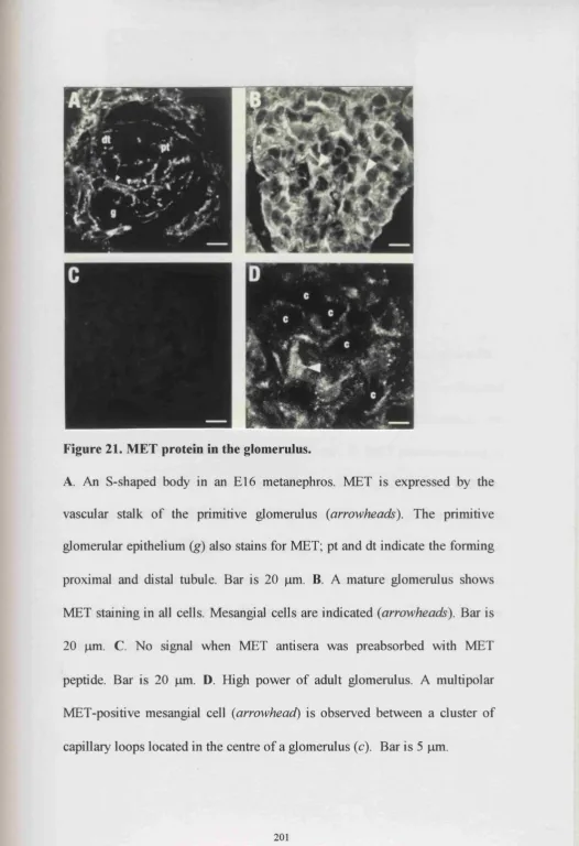 Figure 21. MET protein in the glomerulus.