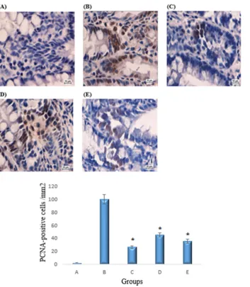 Table 5. Effects of the copper (II) complex on the regionaldistribution of colonic ACF in AOM-induced colonic cancer.