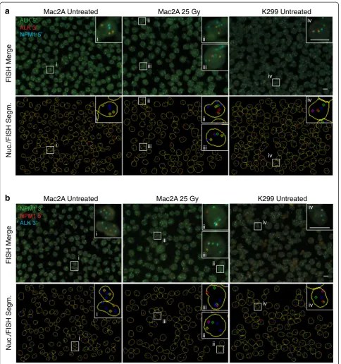 Fig. 3 Qualitative identification of breakage and translocation events with hiBA-FISH.NPM1( a Representative maximal projections of 40× confocalimages of NPM1-ALK translocation-negative Mac2A cells, untreated or treated with 25 Gy of ionizing radiation, an