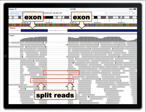 Figure 3 RNA sequencing data. Thin lines connect RNA read segments across splice junctions.