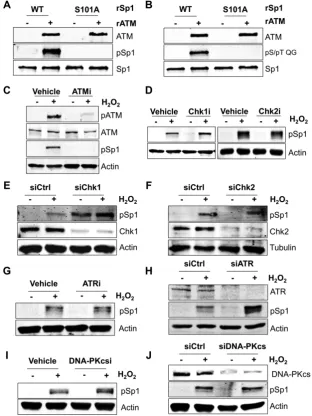 Figure 1. ATM is the main kinase responsible for serine 101 phosphorylation of Sp1. (A and B) Representative in vitro kinase assay using recombinantATM (rATM) and wild-type (WT) or Ser101-Ala mutant (S101A) recombinant Sp1 proteins (rSp1)