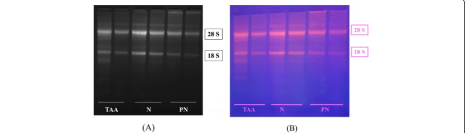 Figure 1 A typical ethidium bromide-stained agarose gel shows the integrity of the extracted RNA; (A) visualized under a VilberLourmat gel documentation system (B) visualized under UV light.
