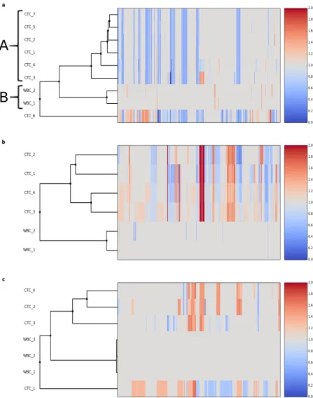 Fig 8. Cluster analysis of copy number profiles for CTCs and WBCs from 3 patients. a) single cells (CTCs and WBCs) from a patientaffected by prostate cancer; cluster A represents 6 CTCs with small or no differences in copy number profiles; cluster B is for