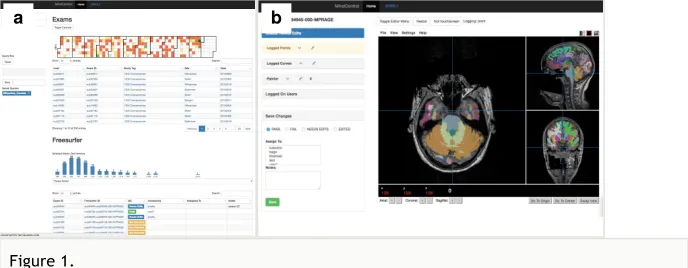 Figure 1. The original Mindcontrol application is shown here. On the left is the dashboard view, with acalendar heatmap plot of exam dates at the top, and a histogram of 3rd-Ventricle volumes from