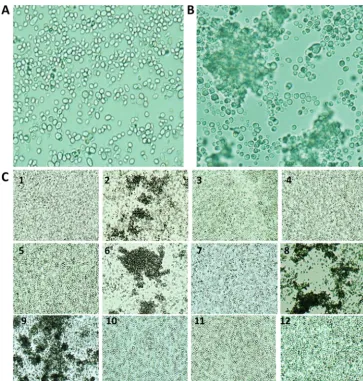 FIG 1 Microscopic appearance of non-aggregate-forming isolates (A) and aggregate-forming isolates (B) ofC