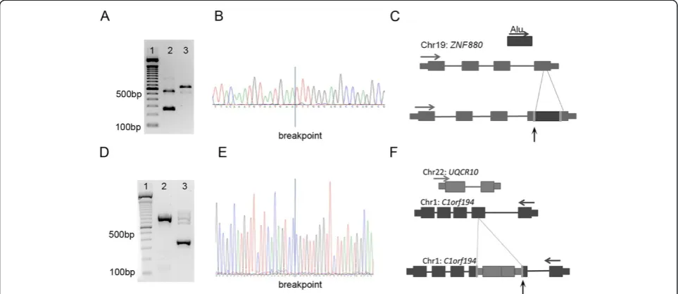 Figure 3 Validation of MEI events detected. (A) Validation of Alu events, bp in brackets correspond to the expected PCR product size of thewild-type allele