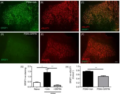 Fig. 6. PSNI increases and intrathecal SRPIN340 reduces SRSF1 expression in the spinal dorsal horn