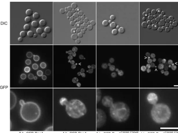 FIG 5 Ras1 is repolarized in a mating-dependent manner. Mating mixtures were prepared from overnight cultures of MATGFP-Ras1 (CBN96) or the palmitoylation-defective GFP-Ras1� wild-type cells expressing eitherC203S, C204S (CBN167) with wild-type MATa cells 