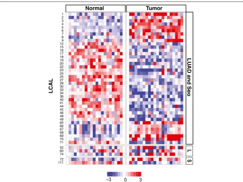 Figure 3 Independent validation of lung cancer-associated lncRNAs. Heatmap of 45 LCALs confirmed as differentially expressed in lungadenocarcinoma tumor and matched normal tissues by Human Exon Array