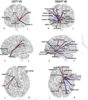 Figure 3. ROIs for which functional connectivity with the VS during anticipation of a large reward versus no reward was associatedLobule; TP = Temporal Pole; SMG = Supramarginal Gyrus; SOG = Superior Occipital Gyrus; SFG = Superior Frontal Gyrus; MFG =Midd