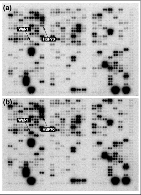 Figure 1A pair of Clontech microarrays hybridized as described in Materials andexpression patterns