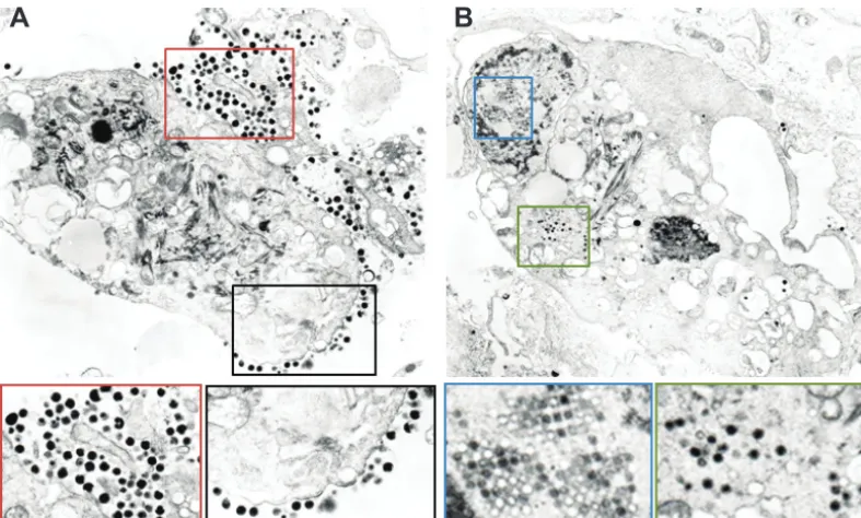 FIG 3 Electron microscopy of the MVI-it cell line identifies viral particles that appear to be BGHV8