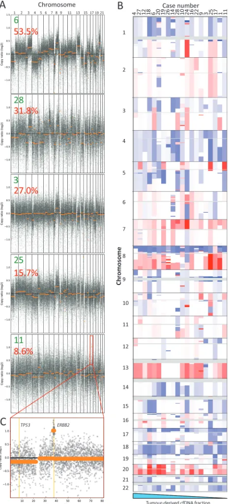 Figure 3 (A) Genome wide copy number aberrations can be detected from targeted cfDNA-Seq, even where tumor content is low