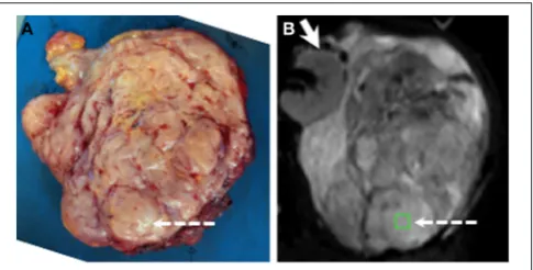 FIGURE 2 | Example showing positioning of ROI for histopathological and