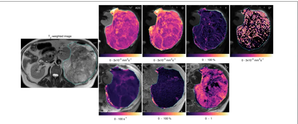 FIGURE 3 | Acquired images and ﬁtted/calculated parameters from the same slice asb Figure 2