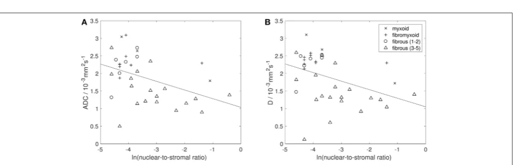 FIGURE 6 | (A) Example of tumor exhibiting high cellularity, with patternless distributions of markedly pleomorphic cells dispersed in moderate amounts ofabundant collagenous stroma (200collagenous stroma (200× magniﬁcation)