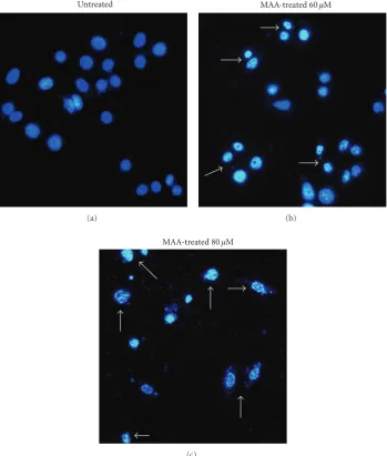 Figure 1: Ewere stained with DAPI and visualized by ﬂuorescence microscopy. The arrows indicate nuclear shrinkage, condensation, or fragmentationﬀect of MAA on nuclear alterations in Ca Ski cells