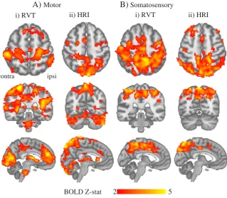 Fig. 3. Group-level correlations between BOLD signal and RVT (i) and HRI (ii) for the motor (A) and the somatosensory (B) experiments