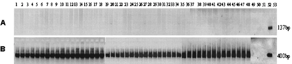 FIG. 2. Results of PCR, using P. carinii(A) Rcc primers; (B) primers directed to rat globin