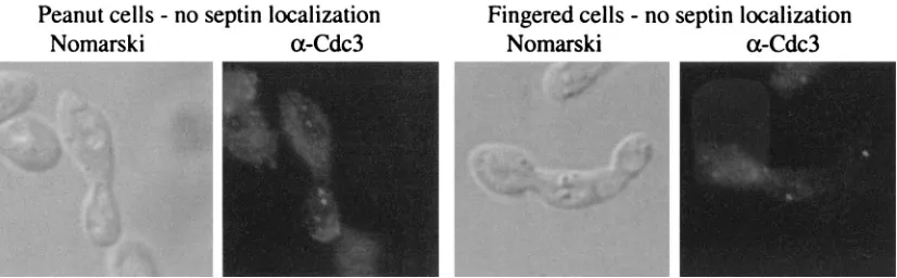 FIG. 3. Septin localization in normal, peanut, and ﬁngered cells. Septins were visualized in the YGS57 (rga1optics was used to examine cell morphology and an� rga2� bem3�) strain