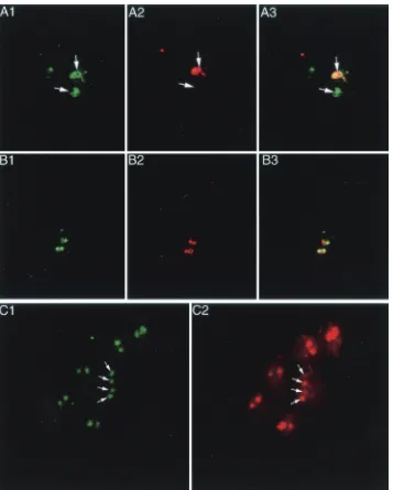 FIG. 4. (A and B) Dual-color FISH with two chromosome 1 probes imaged by confocal microscopy