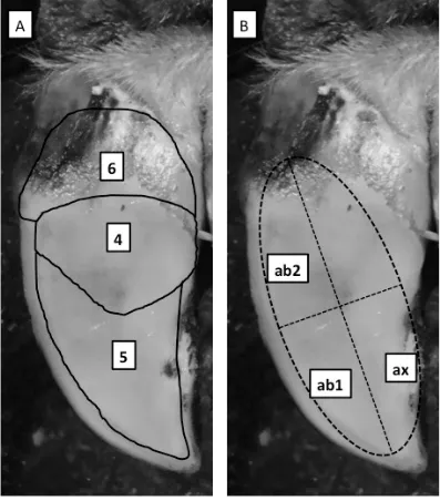 Figure 1 Zones of the distal surface of the claw used to describe location of claw horn lesionsobserved in a study investigating the effect of lesion type at the time of treatment on recovery.Figure 1-A shows zones for sole ulcers and haemorrhage 4= sole, 
