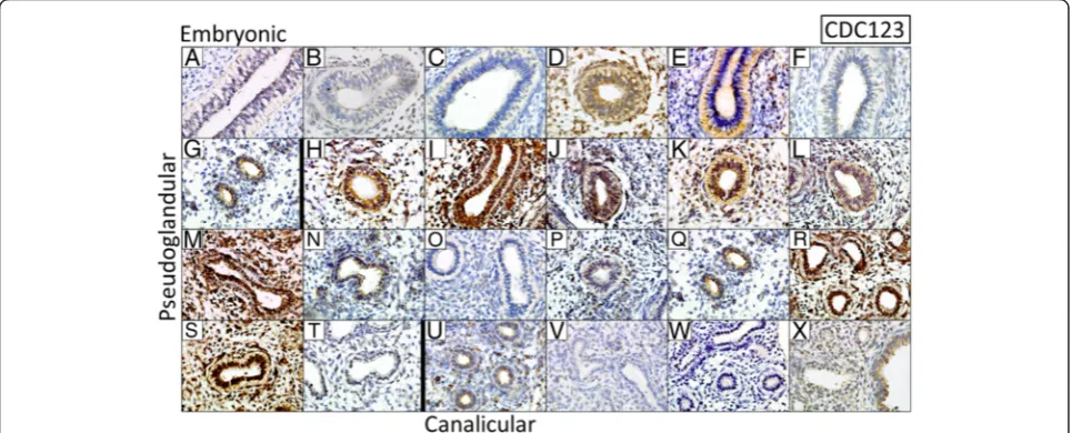 Fig. 3 Immunohistochemistry for TMEM163 in 24 fetal lung samples. Protein expression increases across Pseudoglandular and Canalicular stagesof human fetal lung development