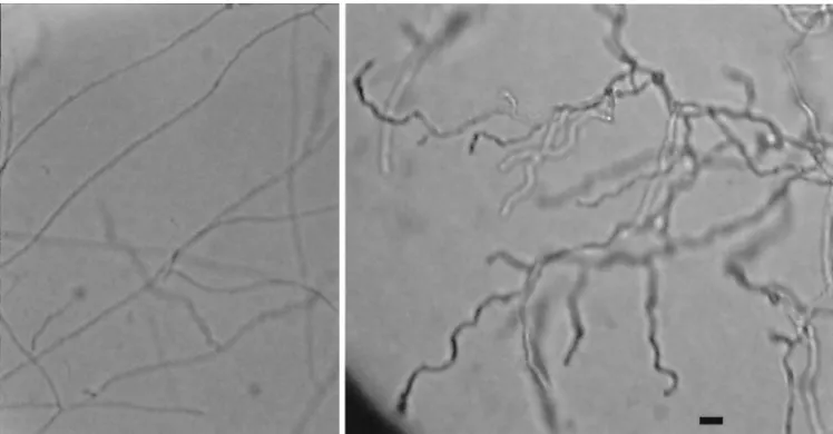 FIG. 10. Microscopic morphology of G184AS ura5photographed at the same magniﬁcation. Bar, 2-11 parental strain (left) and ms8 knockout (right) stained with lactophenol cotton blue and �m.
