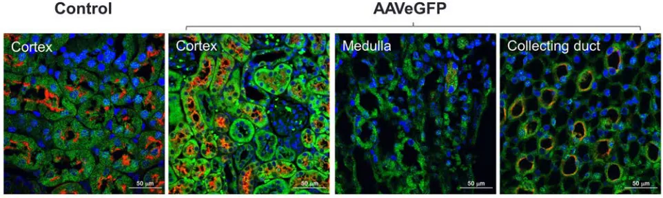 Figure 2. Mice were retrogradely infused in the left kidney via the left ureter with AAVEGFP vector (1 × 1011 viral genome particles/mouse)