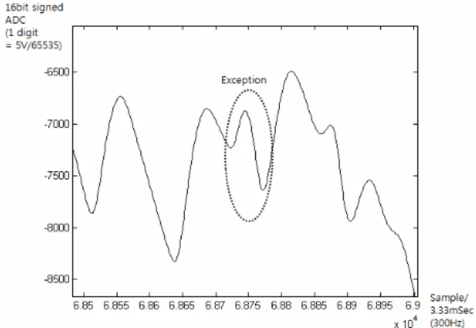 Fig. 2. An abnormal minor peak due to motion artifact or  physiological abnormality 